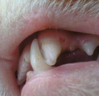 Zlomený zub, ilustrační foto Pavlína Mozgová