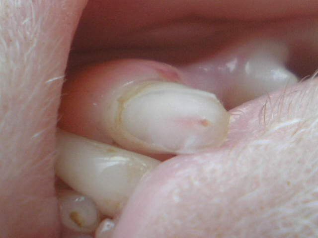 zlomený zub, foto Pavlína Kasslová